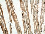 SERTAD1 Antibody in Immunohistochemistry (Paraffin) (IHC (P))