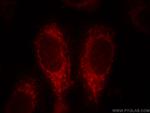 ACSM3 Antibody in Immunocytochemistry (ICC/IF)