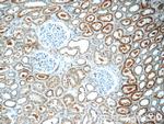 ACSM3 Antibody in Immunohistochemistry (Paraffin) (IHC (P))