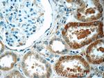 ACSM3 Antibody in Immunohistochemistry (Paraffin) (IHC (P))