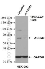 ACSM3 Antibody in Western Blot (WB)