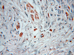 HSBP1 Antibody in Immunohistochemistry (Paraffin) (IHC (P))