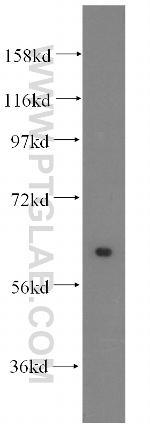 HSBP1 Antibody in Western Blot (WB)