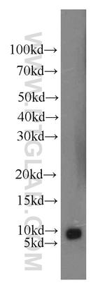 HSBP1 Antibody in Western Blot (WB)