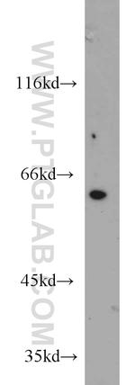 HSBP1 Antibody in Western Blot (WB)