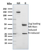 Cdk2/p34cdc2 Serine-Threonine Kinase Antibody in SDS-PAGE (SDS-PAGE)