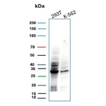 Cdk2/p34cdc2 Serine-Threonine Kinase Antibody in Western Blot (WB)