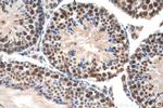 GTF2H1 Antibody in Immunohistochemistry (Paraffin) (IHC (P))