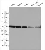 GTF2H1 Antibody in Western Blot (WB)