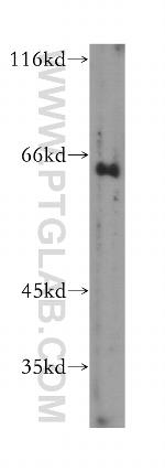 GTF2H1 Antibody in Western Blot (WB)