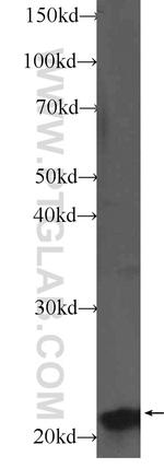 NKIRAS2 Antibody in Western Blot (WB)