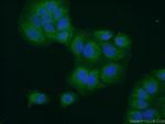 BCS1L Antibody in Immunocytochemistry (ICC/IF)