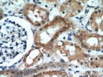BCS1L Antibody in Immunohistochemistry (Paraffin) (IHC (P))