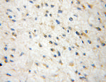 BCS1L Antibody in Immunohistochemistry (Paraffin) (IHC (P))