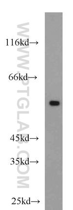 BCS1L Antibody in Western Blot (WB)