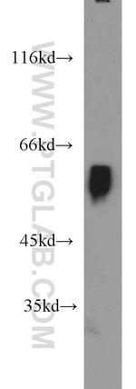 BCS1L Antibody in Western Blot (WB)