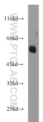 BCS1L Antibody in Western Blot (WB)