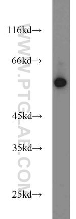 BCS1L Antibody in Western Blot (WB)