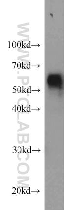 BCS1L Antibody in Western Blot (WB)