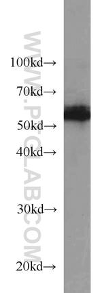 BCS1L Antibody in Western Blot (WB)