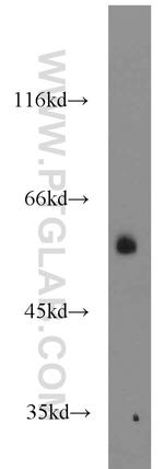 BCS1L Antibody in Western Blot (WB)