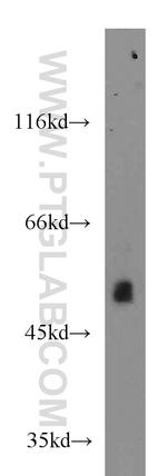 BCS1L Antibody in Western Blot (WB)