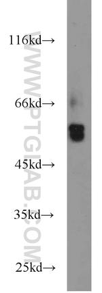 BCS1L Antibody in Western Blot (WB)