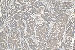 AKT Antibody in Immunohistochemistry (Paraffin) (IHC (P))