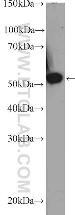 TBRG4 Antibody in Western Blot (WB)