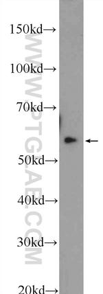 TBRG4 Antibody in Western Blot (WB)