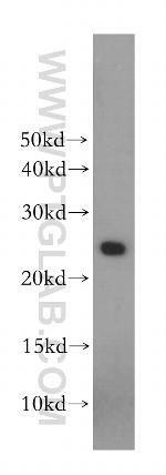 Placental lactogen Antibody in Western Blot (WB)