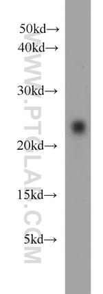 Placental lactogen Antibody in Western Blot (WB)