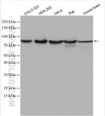 Mitofilin Antibody in Western Blot (WB)