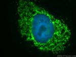 Mitofilin Antibody in Immunocytochemistry (ICC/IF)