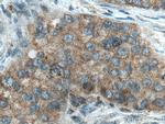 DCTN5 Antibody in Immunohistochemistry (Paraffin) (IHC (P))