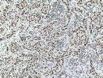 DIDO1 Antibody in Immunohistochemistry (Paraffin) (IHC (P))