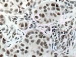 DIDO1 Antibody in Immunohistochemistry (Paraffin) (IHC (P))