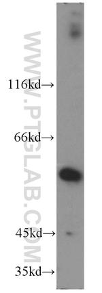 DIDO1 Antibody in Western Blot (WB)