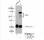 RNF216 Antibody in Immunoprecipitation (IP)