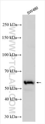 RNF216 Antibody in Western Blot (WB)