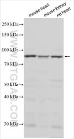 RNF216 Antibody in Western Blot (WB)