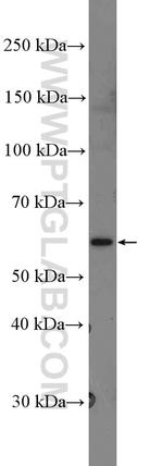 RNF216 Antibody in Western Blot (WB)