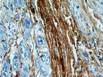 TGFBI / BIGH3 Antibody in Immunohistochemistry (Paraffin) (IHC (P))