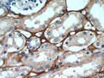 TGFBI / BIGH3 Antibody in Immunohistochemistry (Paraffin) (IHC (P))
