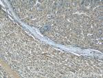 TGFBI / BIGH3 Antibody in Immunohistochemistry (Paraffin) (IHC (P))