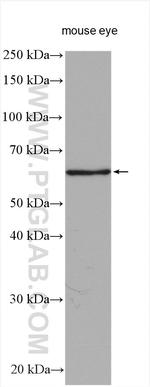 TGFBI / BIGH3 Antibody in Western Blot (WB)
