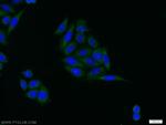 IGFBP3 Antibody in Immunocytochemistry (ICC/IF)