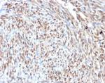 CDK4 Recombinant Rabbit Monoclonal Antibody (CDK4/7987R)
