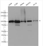 GNL2 Antibody in Western Blot (WB)