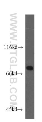 ECD Antibody in Western Blot (WB)